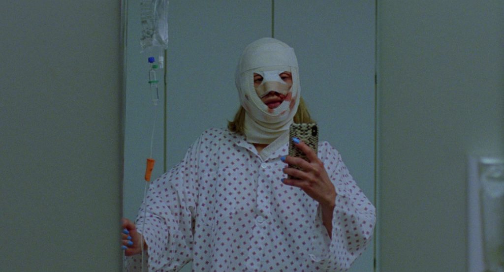 Sick of Myself: il body horror del narcisismo e l'economia dell'attenzione